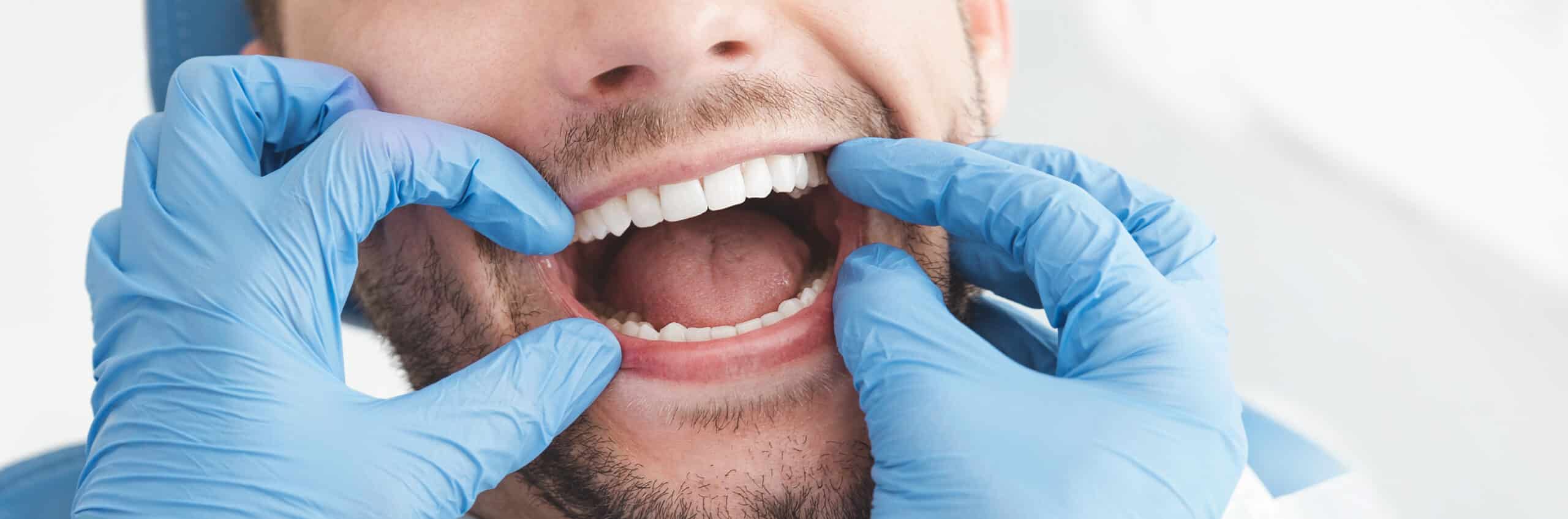 dont-skip-oral-cancer-screenings-a-lifesaving-routine-you-might-be-ignoring