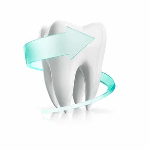 fort-collins-teeth-whitening-offer
