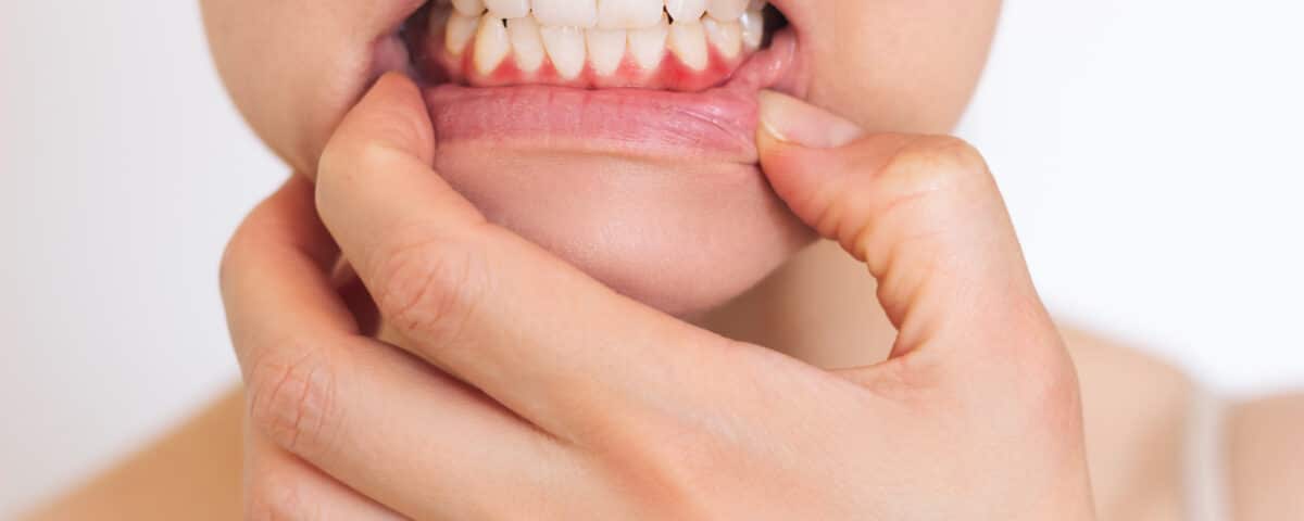 In this blog post, we'll explore why tooth sensitivity is so common, what causes it, and what measures you can take to manage or even prevent it.