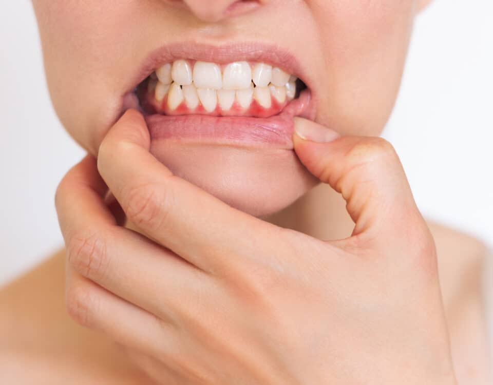 In this blog post, we'll explore why tooth sensitivity is so common, what causes it, and what measures you can take to manage or even prevent it.