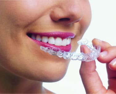 invisalign preferred provider fort collins