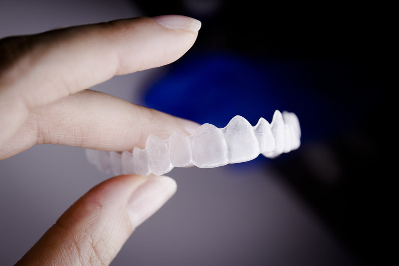 Invisalign Benefits