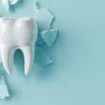 is-it-possible-to-repair-a-chipped-tooth