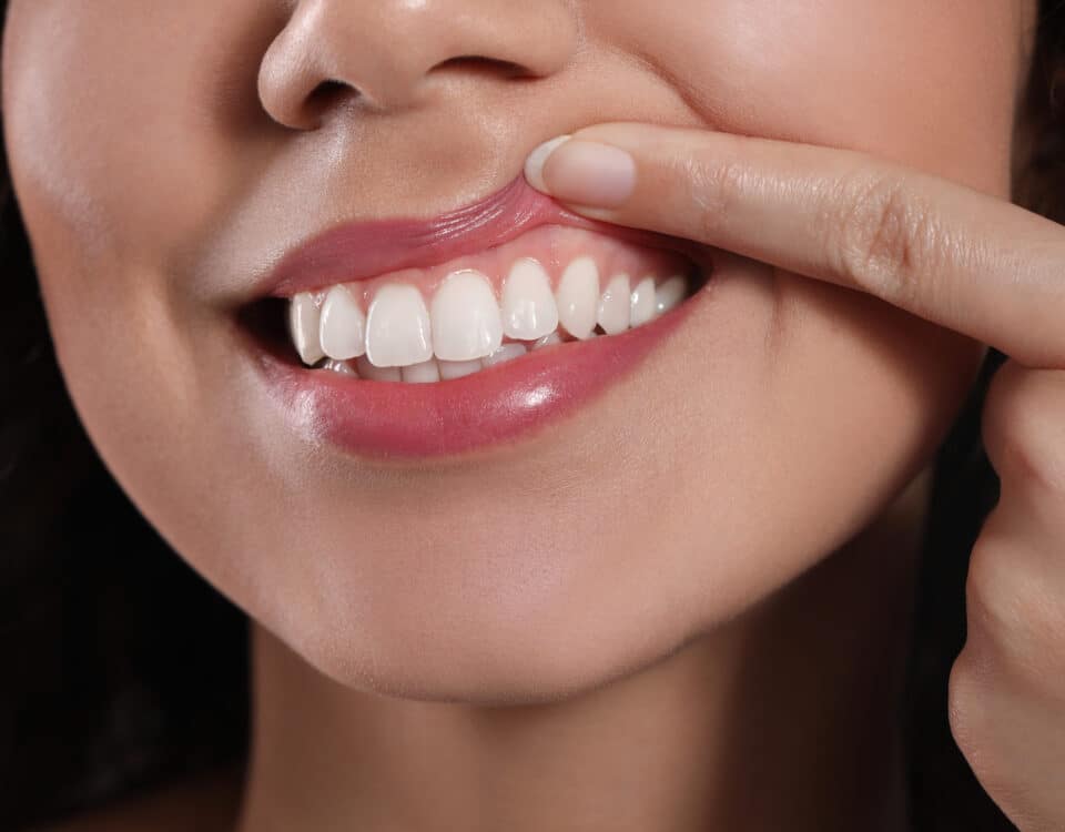 protect-your-smile-with-healthy-gums