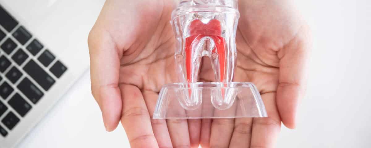 root-canal-awareness-week-what-you-need-to-know-about-saving-your-tooth