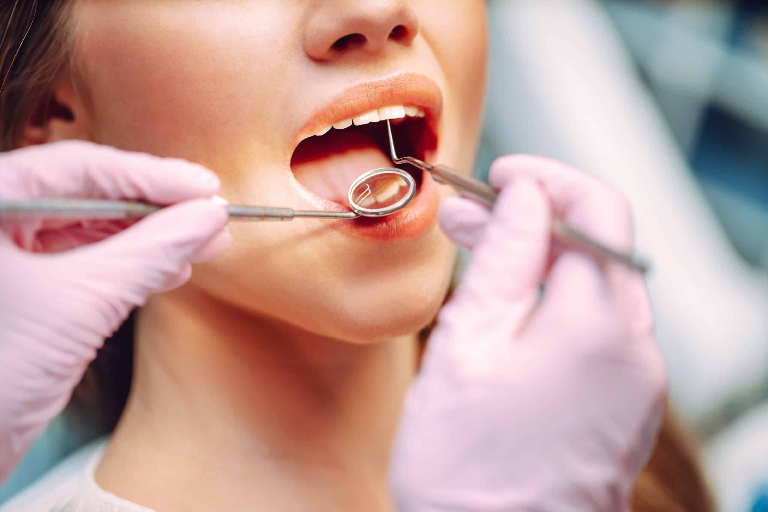 schedule-your-comprehensive-dental-exam-before-the-end-of-the-year