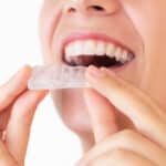 strategies-for-treating-bruxism-and-saving-your-smile