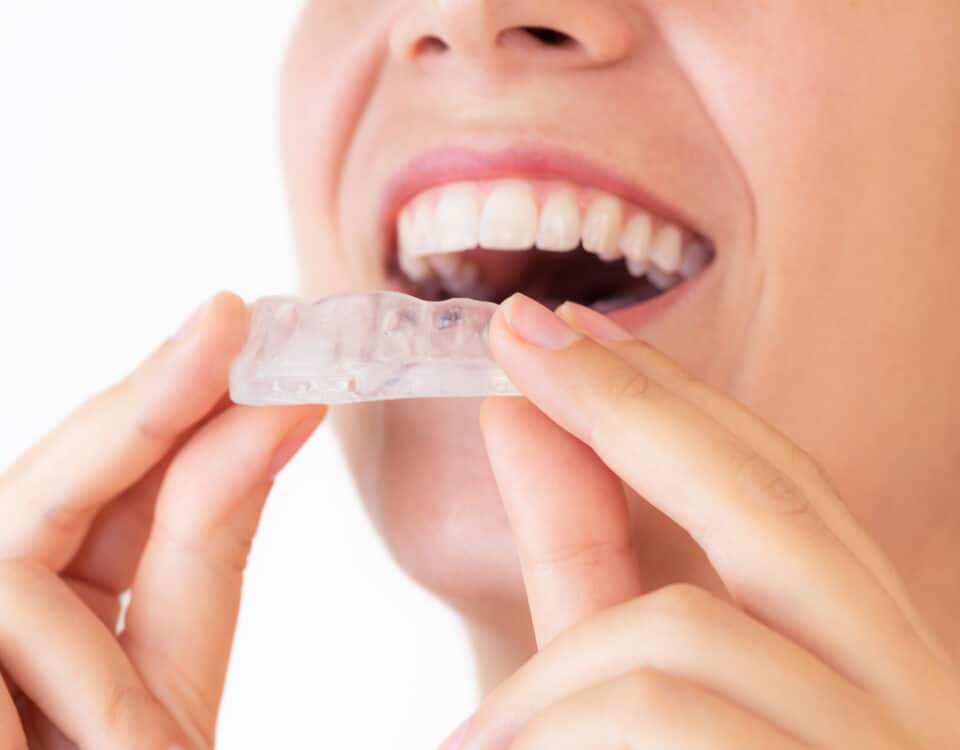 strategies-for-treating-bruxism-and-saving-your-smile