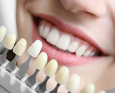 teeth whitening fort collins