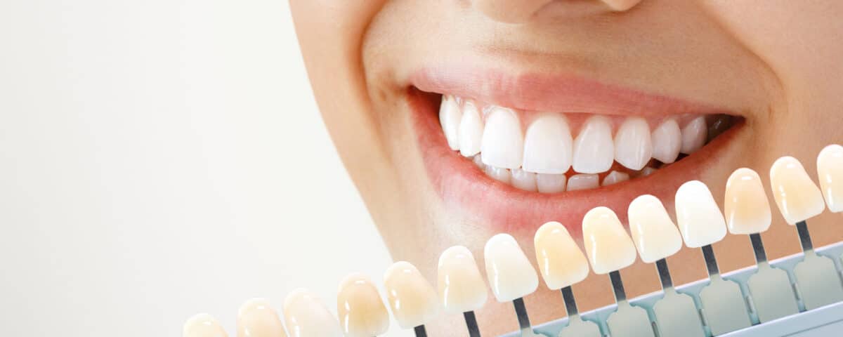 teeth-whitening-safe-effective-and-professional-results