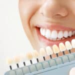teeth-whitening-safe-effective-and-professional-results