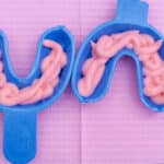 the-benefits-of-fluoride-for-lifelong-dental-health