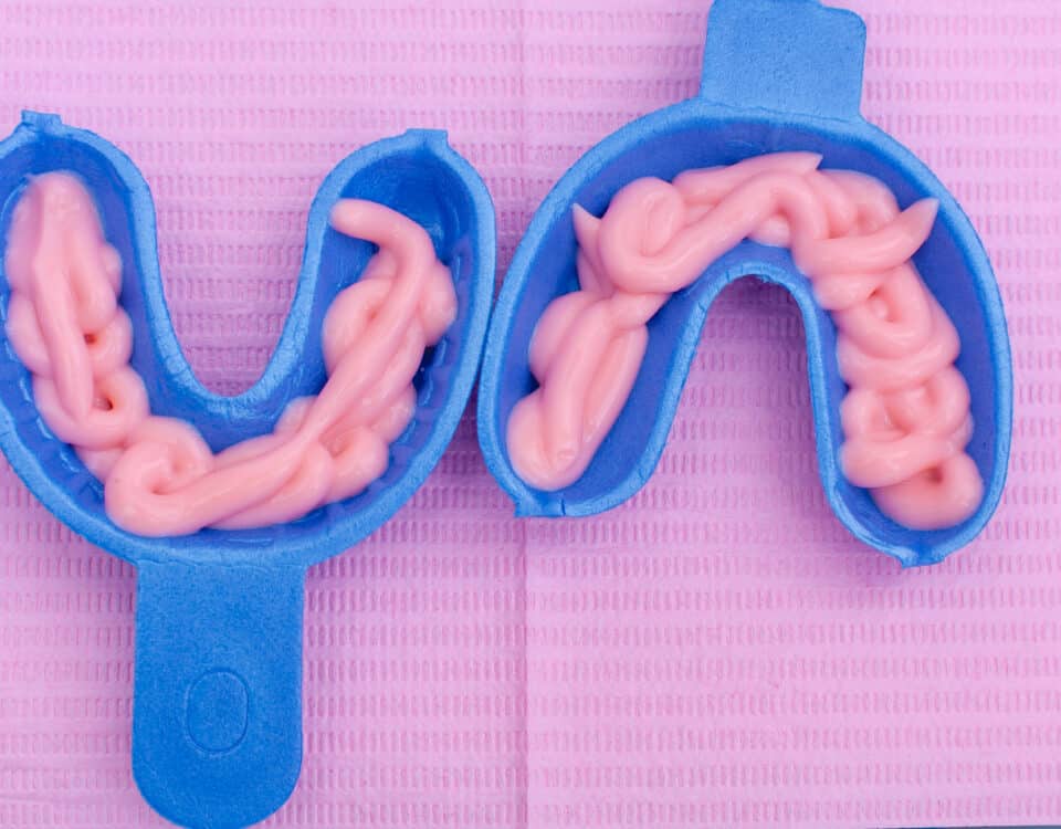 the-benefits-of-fluoride-for-lifelong-dental-health