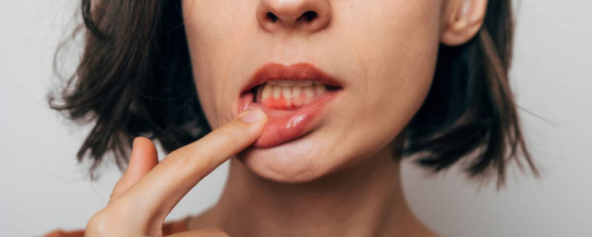 the-growing-threat-of-gum-disease