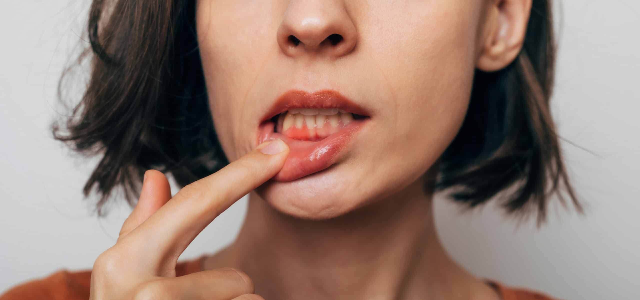 the-growing-threat-of-gum-disease