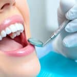 the-magic-of-dental-bonding-ways-to-fix-chips-cracks-and-gaps