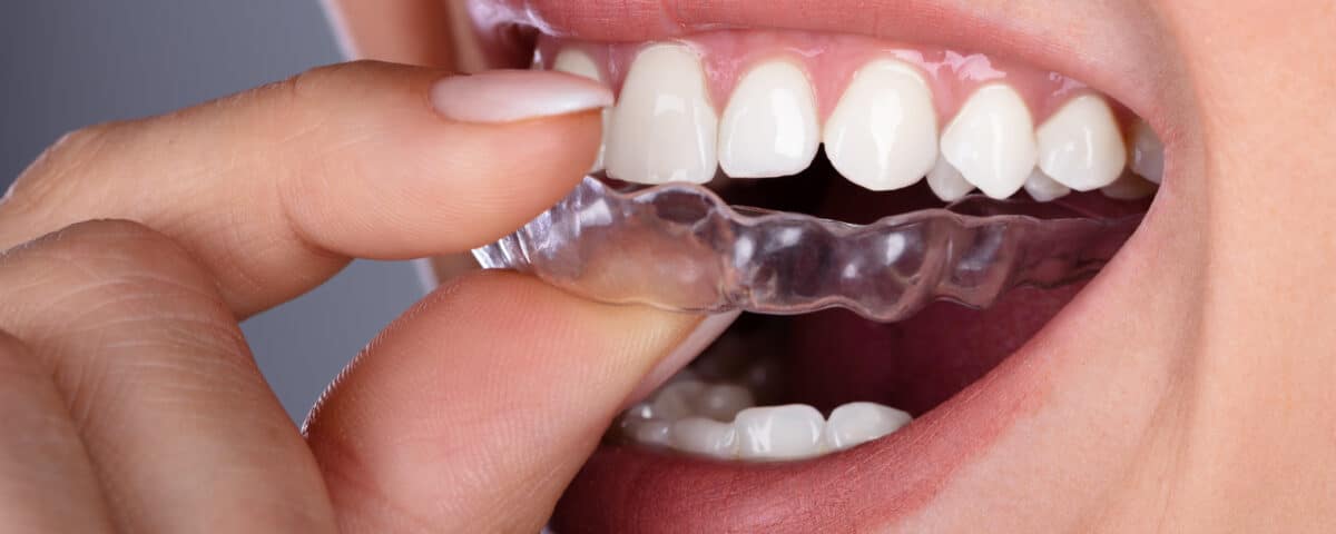 tips-for-ending-bruxism-and-protecting-your-teeth