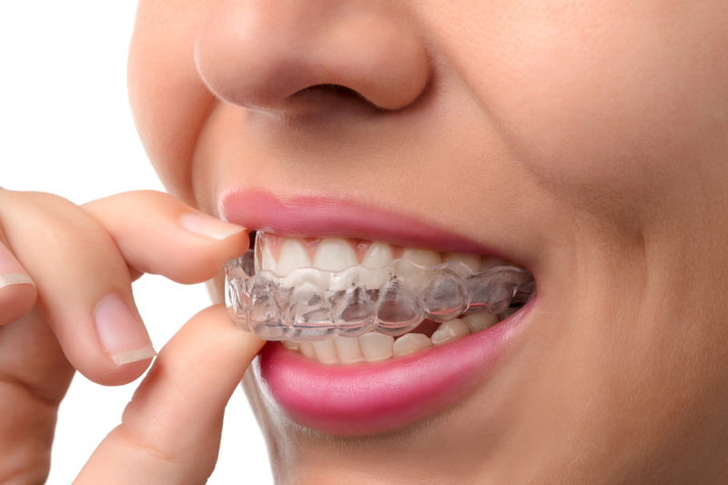 Tips for Using Invisalign®