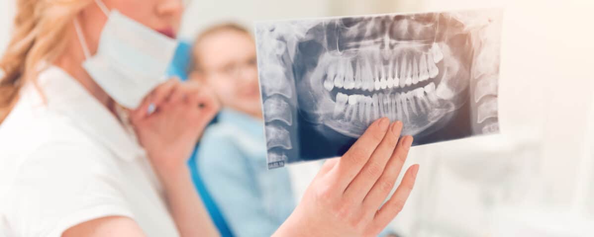what-happens-when-your-wisdom-teeth-grow-in