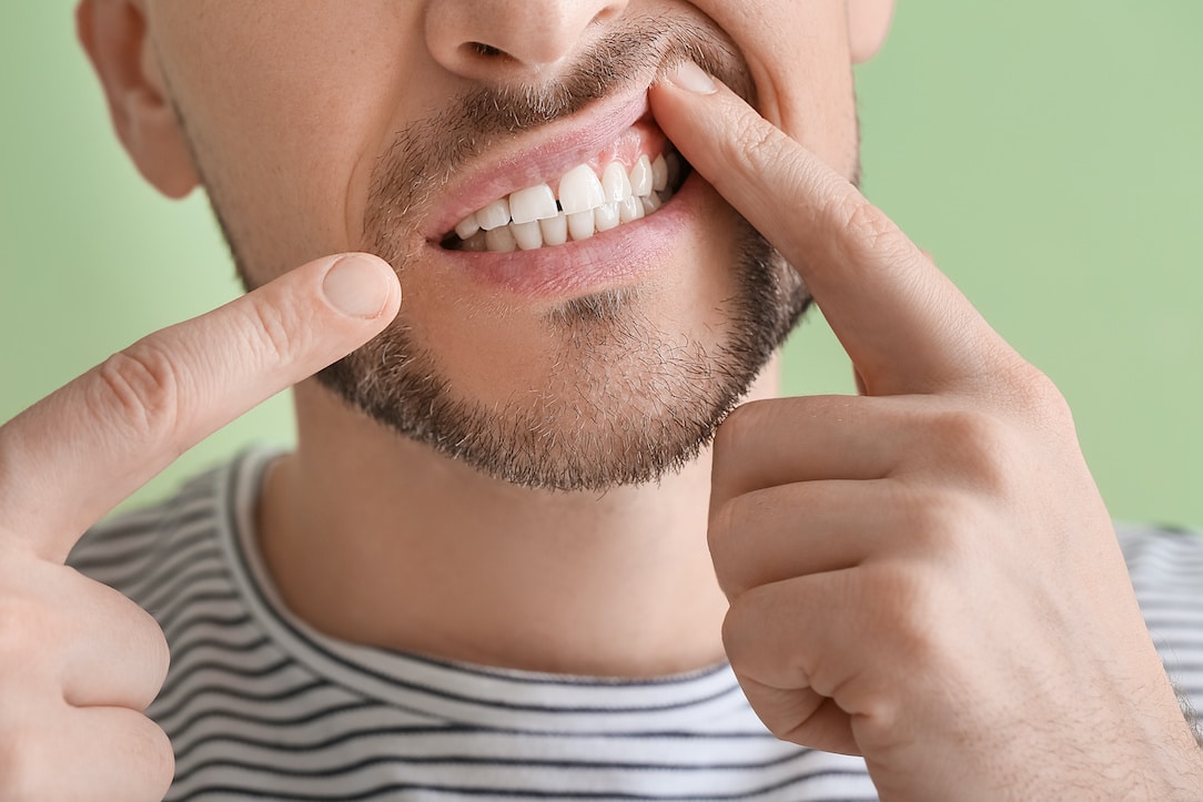 why-do-my-gums-hurt-when-i-brush-my-teeth-causes-and-solutions